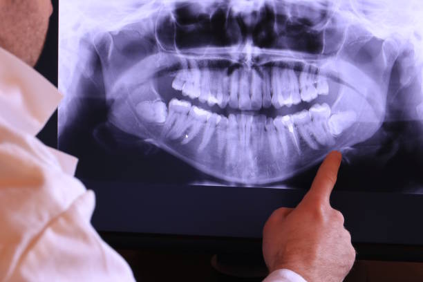 Best Tooth Infection Emergency Dentist  in Milbank, SD