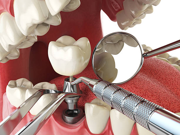 Best Cracked Tooth Emergency Dentist  in Milbank, SD